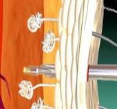 腋臭日常防护 腋臭表皮.jpg